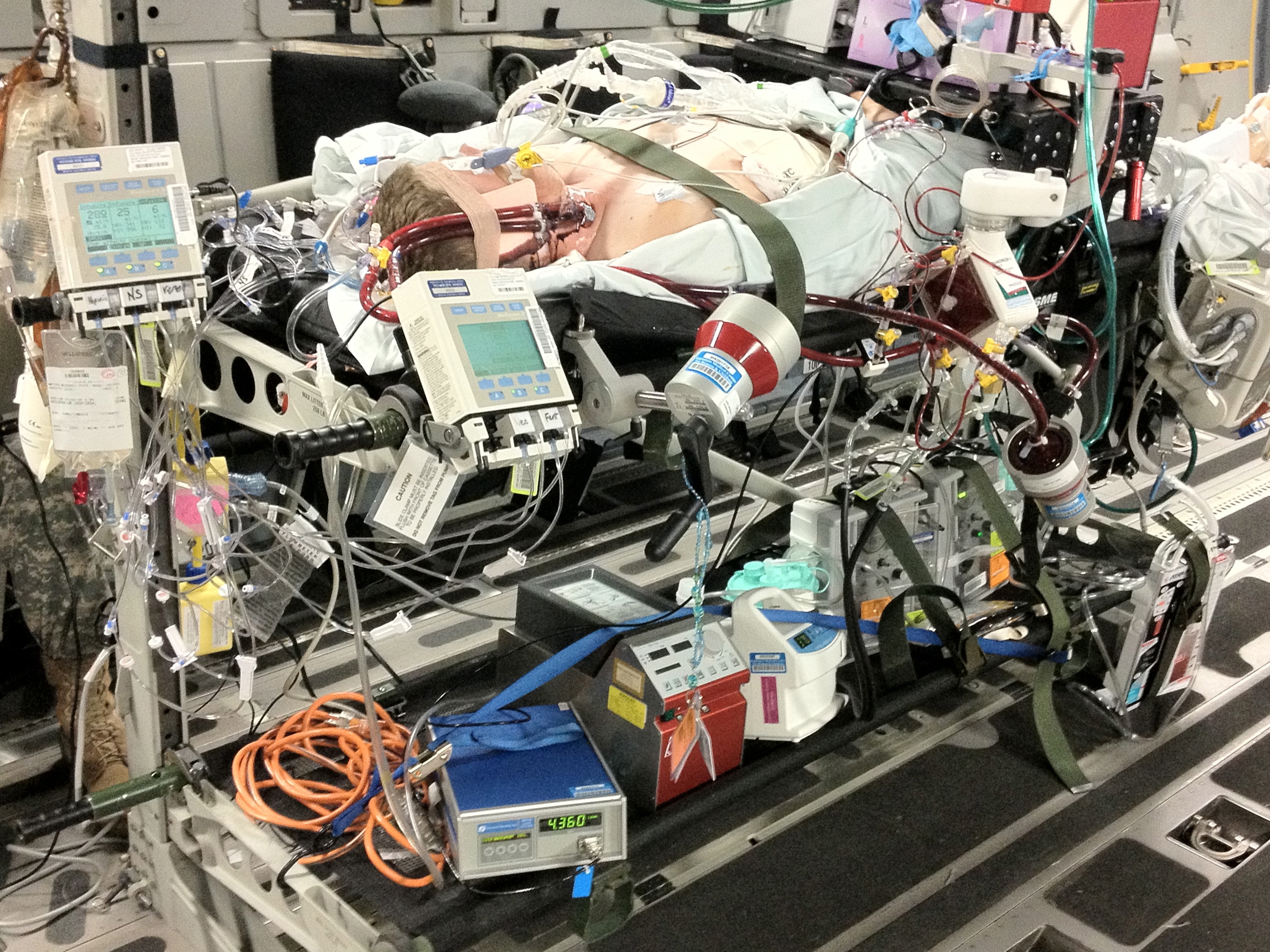 #Reanimate16: What We Can Learn From Resuscitators Around the World?