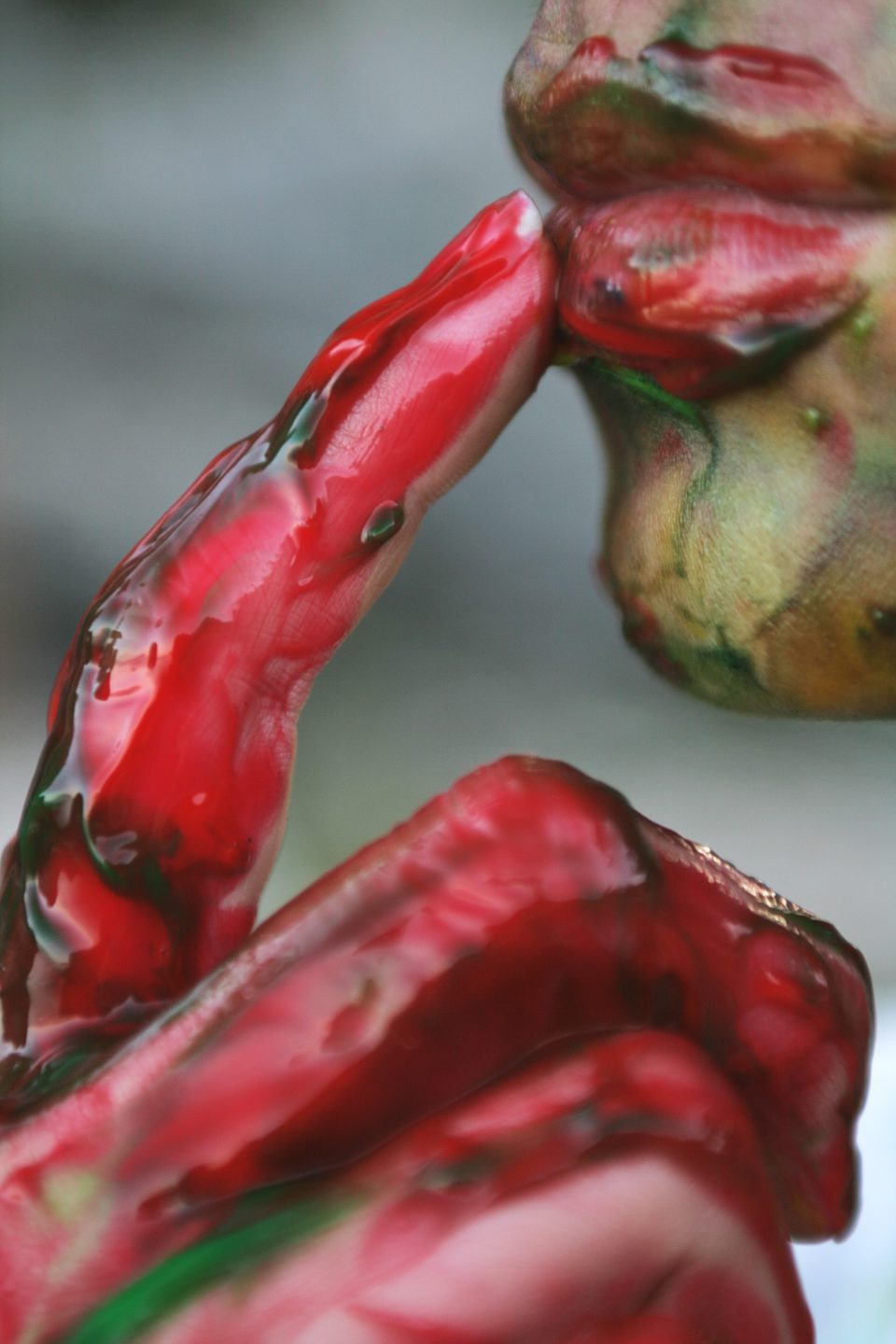 A Bloody Mess: an Update on UGIB Management in the ED