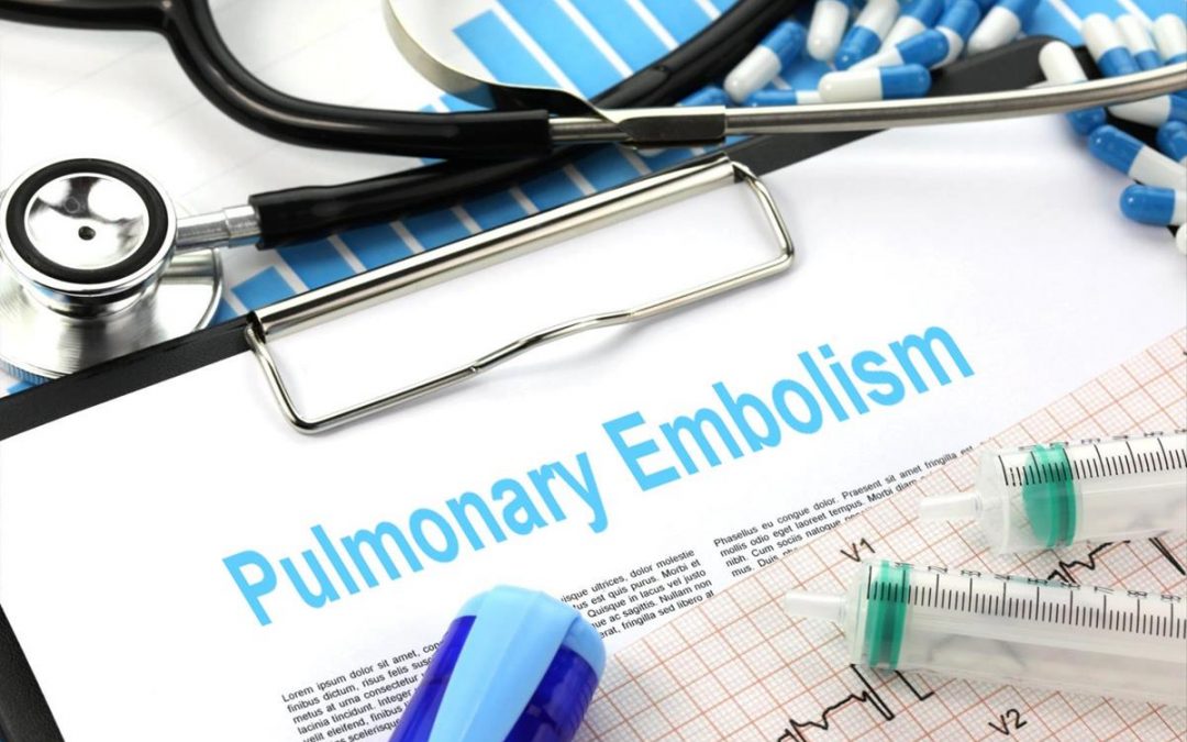 Diuretic vs. placebo in intermediate-risk acute pulmonary embolism: a randomized clinical trial