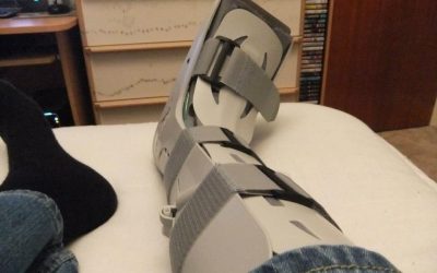 Plaster cast versus functional brace for non-surgical treatment of Achilles tendon rupture (UKSTAR): a multicentre randomised controlled trial and economic evaluation
