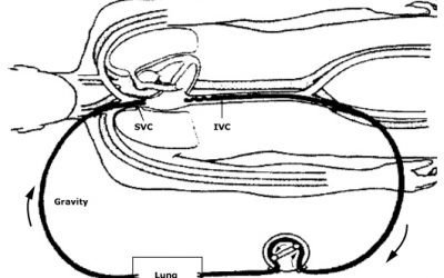 Are We Ready for ECMO on the Ground Floor?