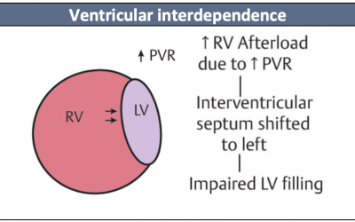 Mastering the myocardium: Cardiogenic Shock