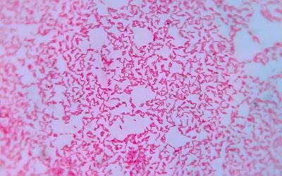 Effect of C-Reactive Protein-Guided Antibiotic Treatment Duration, 7-Day Treatment, or 14-Day Treatment on 30-Day Clinical Failure Rate in Patients with Uncomplicated Gram-Negative Bacteremia: A Randomized Clinical Trial