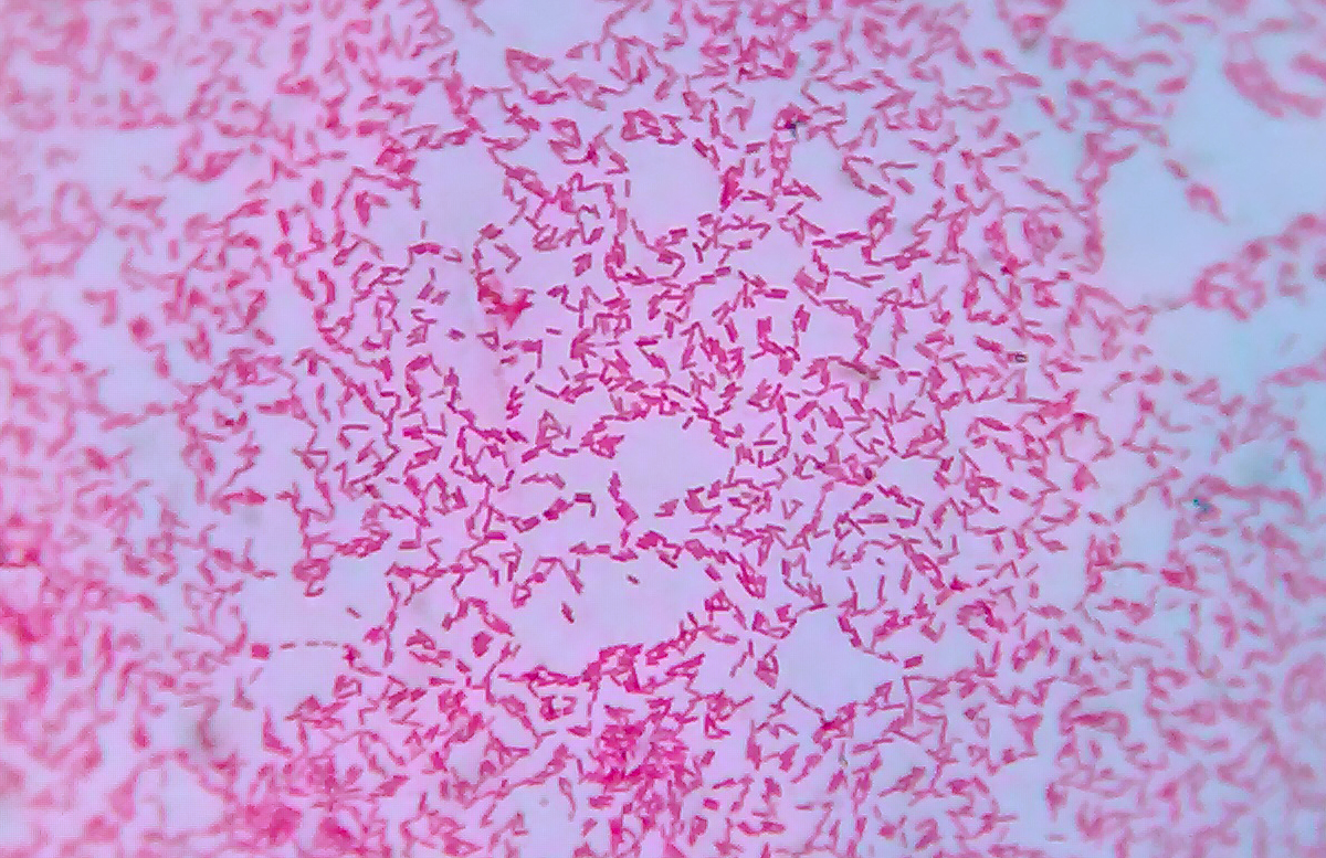 Микропрепарат бактерий. Клебсиелла пневмония под микроскопом. Клебсиелла по Граму. Klebsiella pneumoniae микроскопия. Klebsiella pneumoniae микробиология.