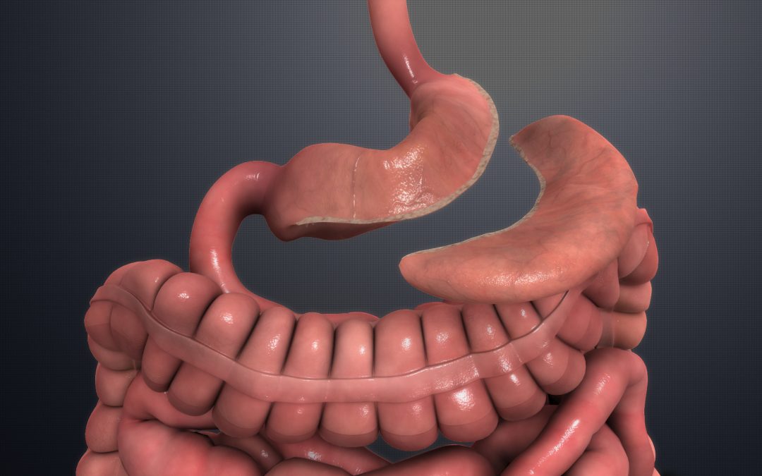 Bariatric Surgery Complications in the ED