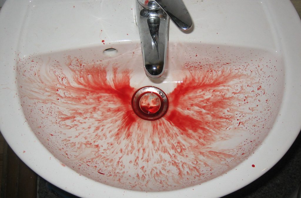 sink nose bleed