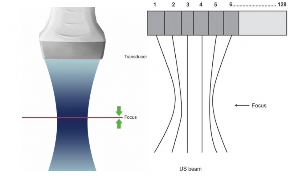 FOCUS your PoCUS! - EMOttawa Blog
