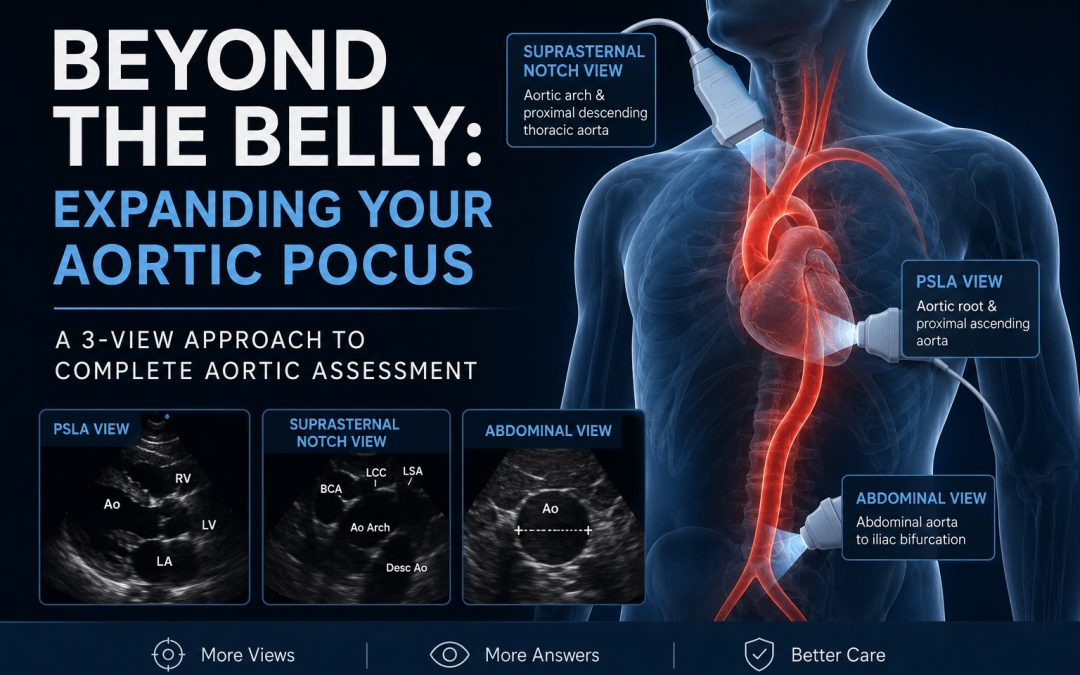 Beyond the Belly: Expanding your Aortic PoCUS