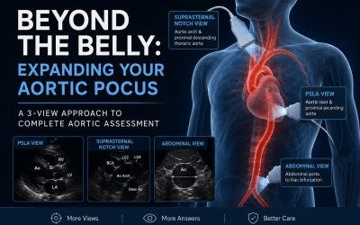Beyond the Belly: Expanding your Aortic PoCUS
