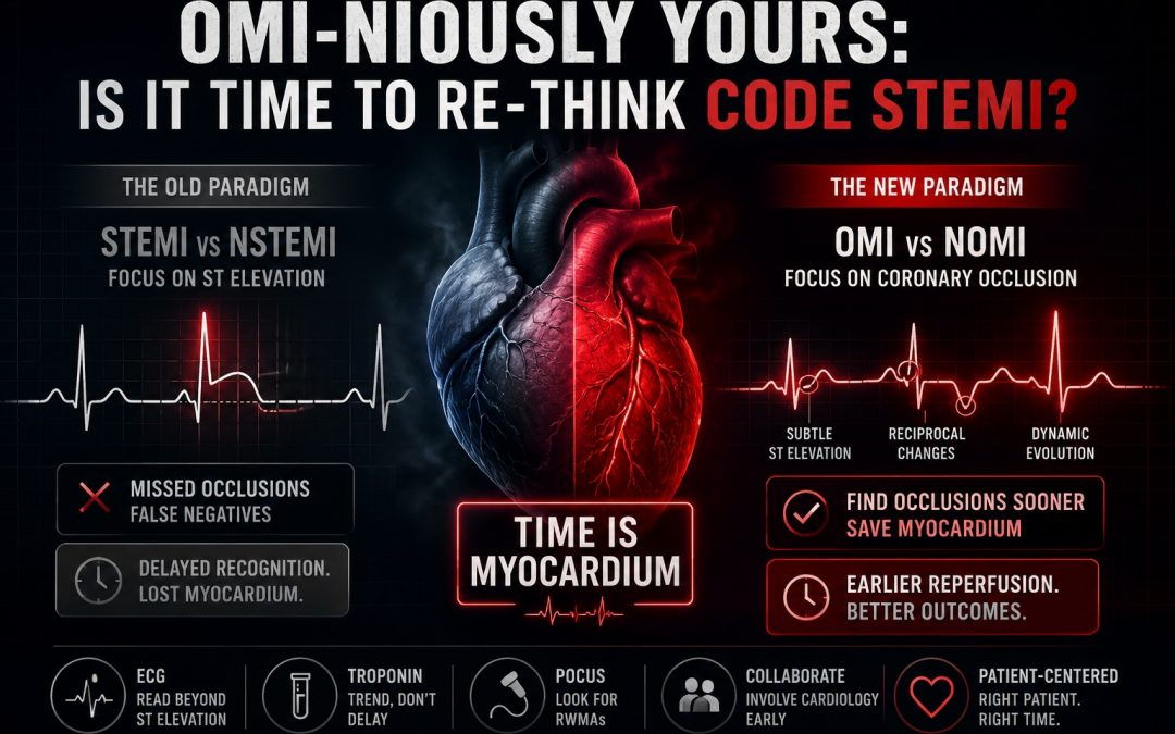 OMI-nously Yours: Is it time to re-think Code STEMI?