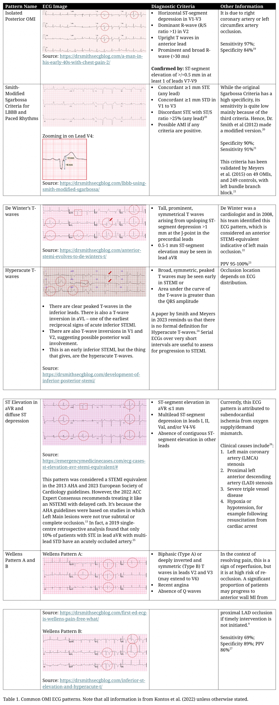 STEMI